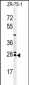 NAT8 Antibody (Center)